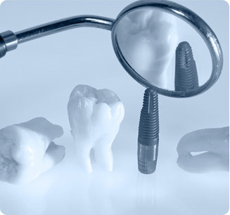 Aparatos que utilizan los dentistas